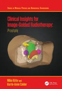 Clinical Insights for Image-Guided Radiotherapy: Prostate