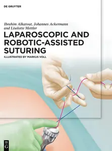 Laparoscopic and Robotic-Assisted Suturing