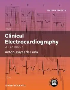 Clinical Electrocardiography: A Textbook