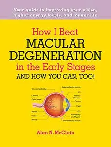 How I Beat Macular Degeneration in the Early Stages and How You Can, Too!