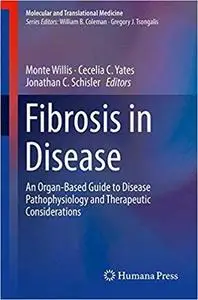 Fibrosis in Disease: An Organ-Based Guide to Disease Pathophysiology and Therapeutic Considerations