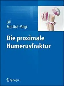 Die proximale Humerusfraktur (Repost)