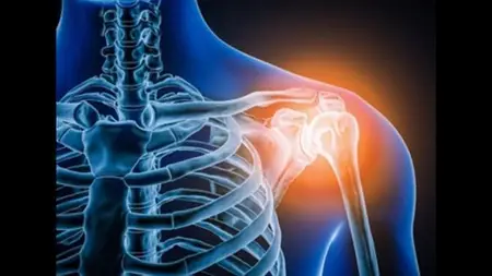 Radiology X-Ray Of Shoulder Joint