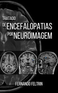 Tratado de Encefalopatias por Neuroimagem: Fernando Belomé Feltrin (Portuguese Edition)