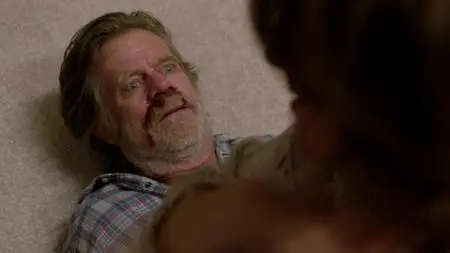 Shameless S09E06