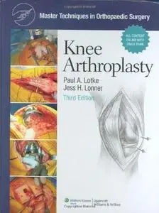 Master Techniques in Orthopaedic Surgery: Knee Arthroplasty (Repost)