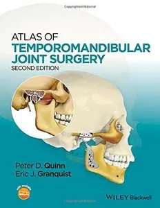 Atlas of Temporomandibular Joint Surgery, 2nd Edition