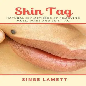 «Skin Tag : Natural DIY Methods of removing Mole, Wart and Skin Tag» by Singe Lamett