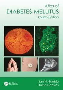 Atlas of Diabetes Mellitus, 4th Edition