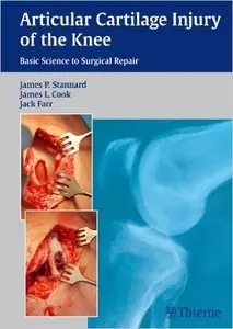 Articular Cartilage Injury of the Knee: Basic Science to Surgical Repair  (repost)