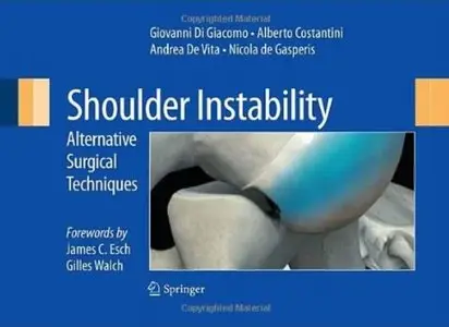 Shoulder Instability: Alternative Surgical Techniques [Repost]