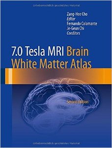7.0 Tesla MRI Brain White Matter Atlas, 2nd edition