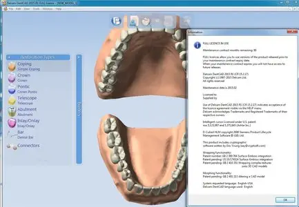 Delcam DentCAD 2015 R1