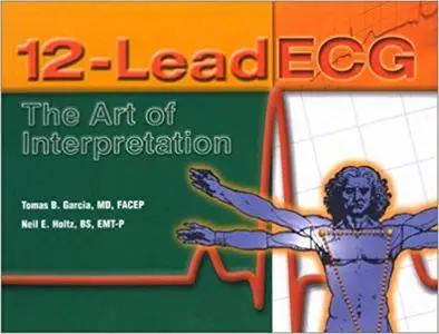 12-Lead ECG: The Art of Interpretation