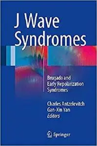 J Wave Syndromes: Brugada and Early Repolarization Syndromes [Repost]