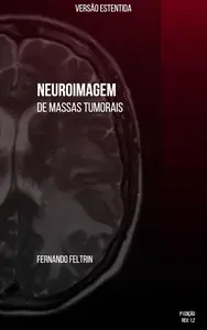 Neuroimagem de Massas Tumorais: Versão Estendida (Portuguese Edition)