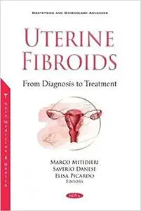 Uterine Fibroids from Diagnosis to Treatment