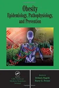 Obesity: Epidemiology, Pathophysiology, and Prevention