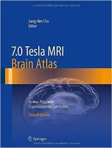 7.0 Tesla MRI Brain Atlas: In-vivo Atlas with Cryomacrotome Correlation [Repost]