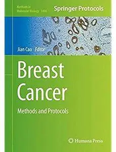 Breast Cancer: Methods and Protocols [Repost]