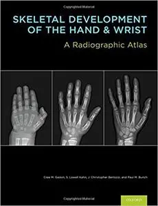 Skeletal Development of the Hand and Wrist: A Radiographic Atlas and Digital Bone Age Companion
