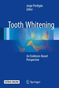 Tooth Whitening: An Evidence-Based Perspective