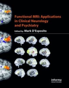 Functional MRI: Applications in Clinical Neurology and Psychiatry (repost)