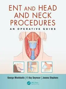 ENT and Head and Neck Procedures: An Operative Guide (Repost)
