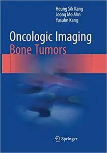 Oncologic Imaging: Bone Tumors (Repost)