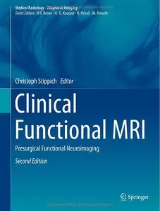 Clinical Functional MRI: Presurgical Functional Neuroimaging