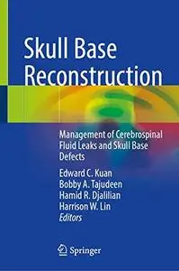 Skull Base Reconstruction: Management of Cerebrospinal Fluid Leaks and Skull Base Defects