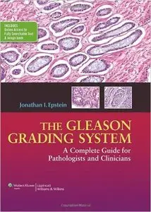 The Gleason Grading System: A Complete Guide for Pathologist and Clinicians