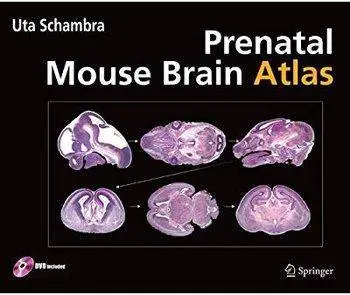 Prenatal Mouse Brain Atlas [Repost]