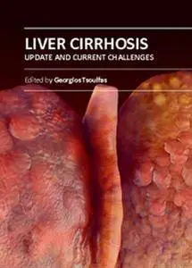 "Liver Cirrhosis: Update and Current Challenges" ed. by Georgios Tsoulfas