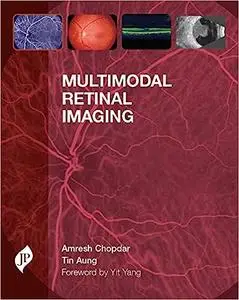 Multimodal Retinal Imaging