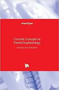 Current Concepts in Dental Implantology