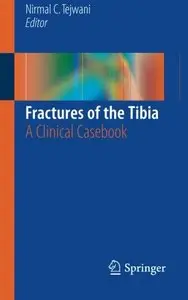 Fractures of the Tibia