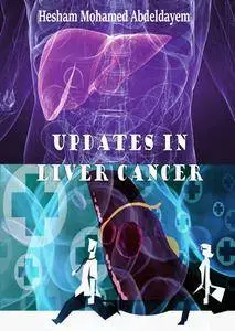 "Updates in Liver Cancer" ed. by Hesham Mohamed Abdeldayem