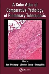 A Color Atlas of Comparative Pathology of Pulmonary Tuberculosis [Repost]