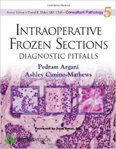 Intraoperative Frozen Sections: Diagnostic Pitfalls