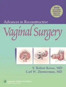 Advances in Reconstructive Vaginal Surgery [Repost]