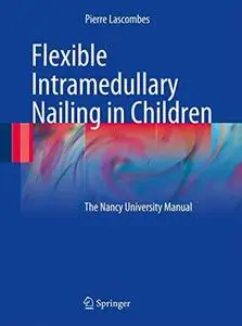 Flexible Intramedullary Nailing in Children: The Nancy University Manual