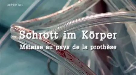 (Arte) Malaise au pays de la prothèse (2014)
