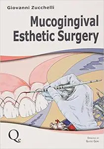 Mucogingival Esthetic Surgery