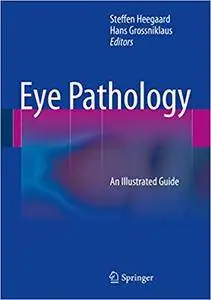 Eye Pathology: An Illustrated Guide (Repost)