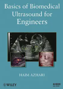 Basics of Biomedical Ultrasound for Engineers (Repost)