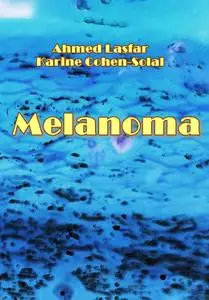 "Melanoma" ed. by Ahmed Lasfar, Karine Cohen-Solal