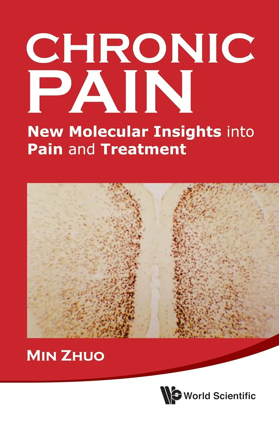 chronic-pain-new-molecular-insights-into-pain-and-treatment-avaxhome