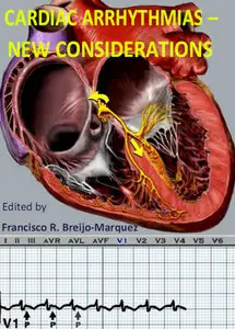 "Cardiac Arrhythmias: New Considerations" ed. by Francisco R. Breijo-Marquez