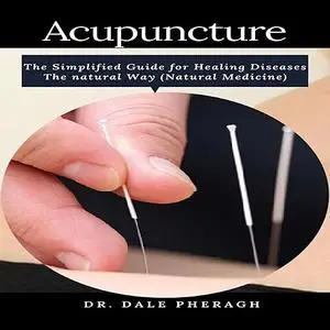 «Acupuncture: The Simplified Guide for Healing Diseases The natural Way (Natural Medicine)» by Dale Pheragh